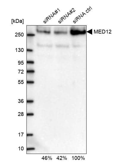 MED12 Antibody - BSA Free Western Blot: MED12 Antibody - BSA Free [NBP1-86669]