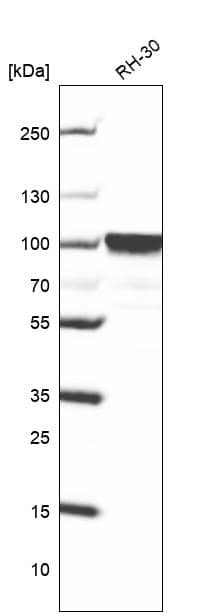 FoxP2 Antibody - BSA Free Western Blot: FoxP2 Antibody - BSA Free [NBP1-86671]