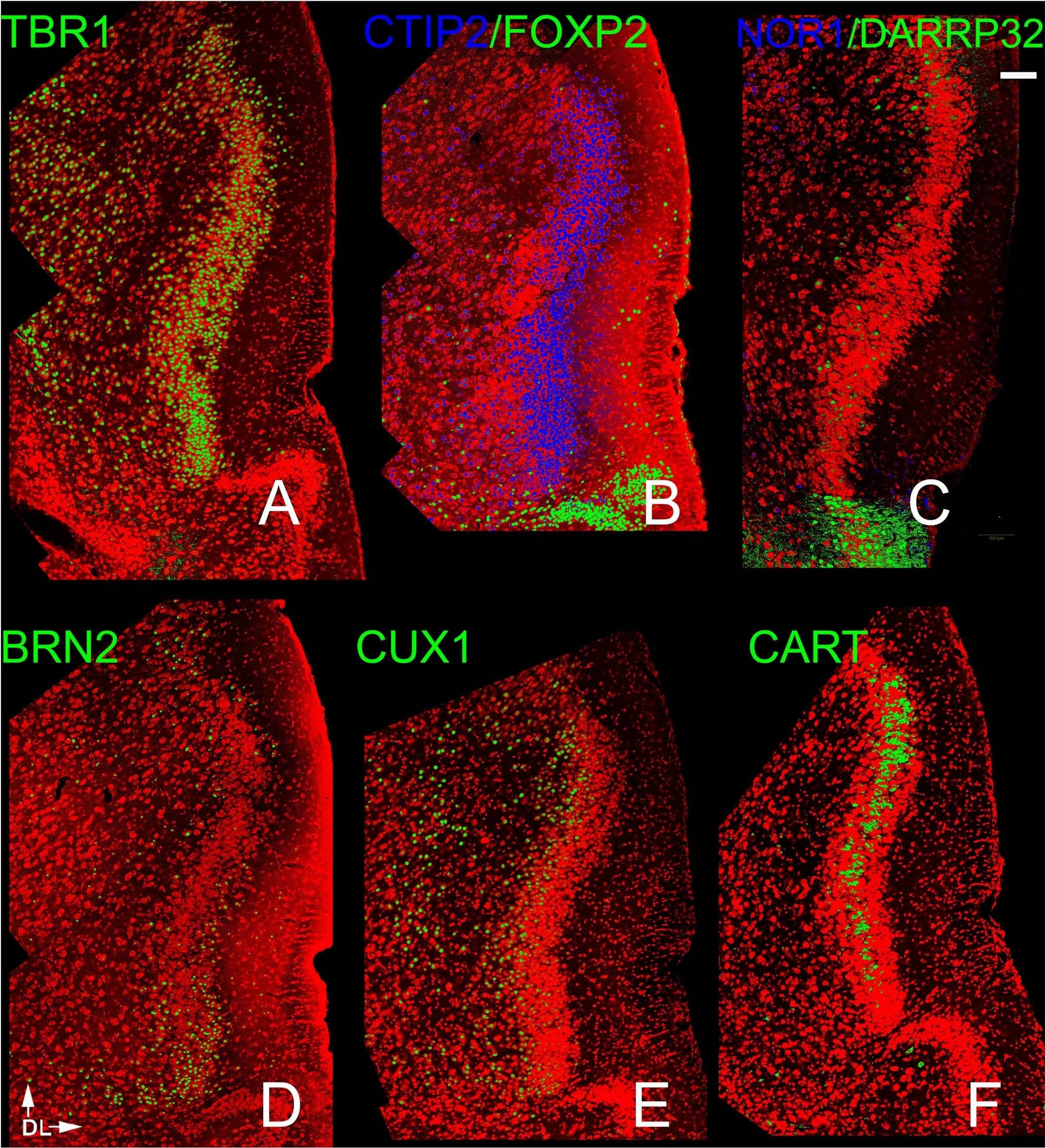 FoxP2 Antibody
