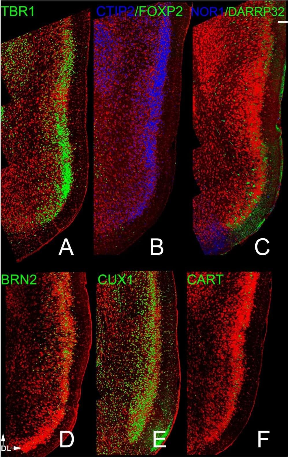 FoxP2 Antibody