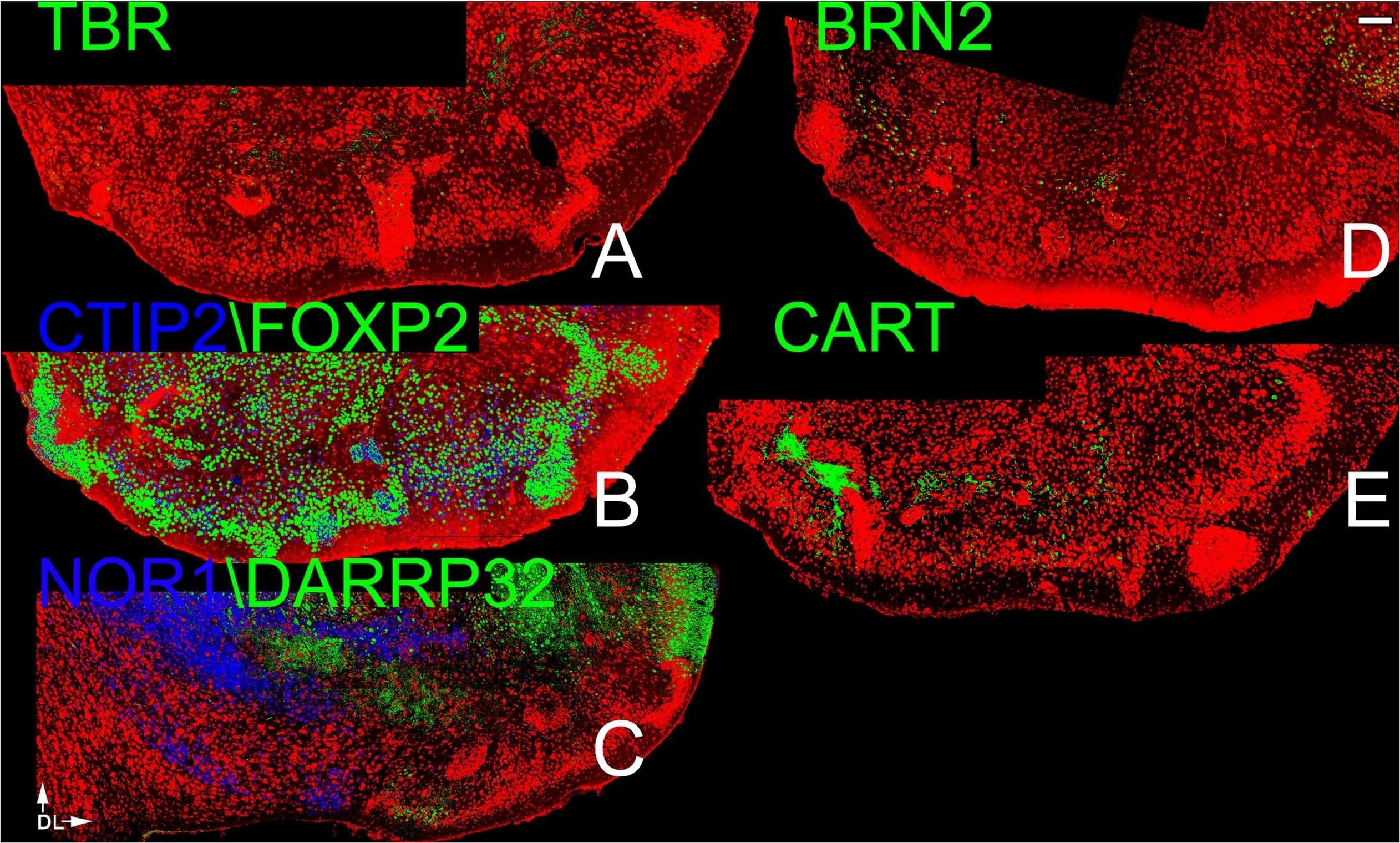 FoxP2 Antibody