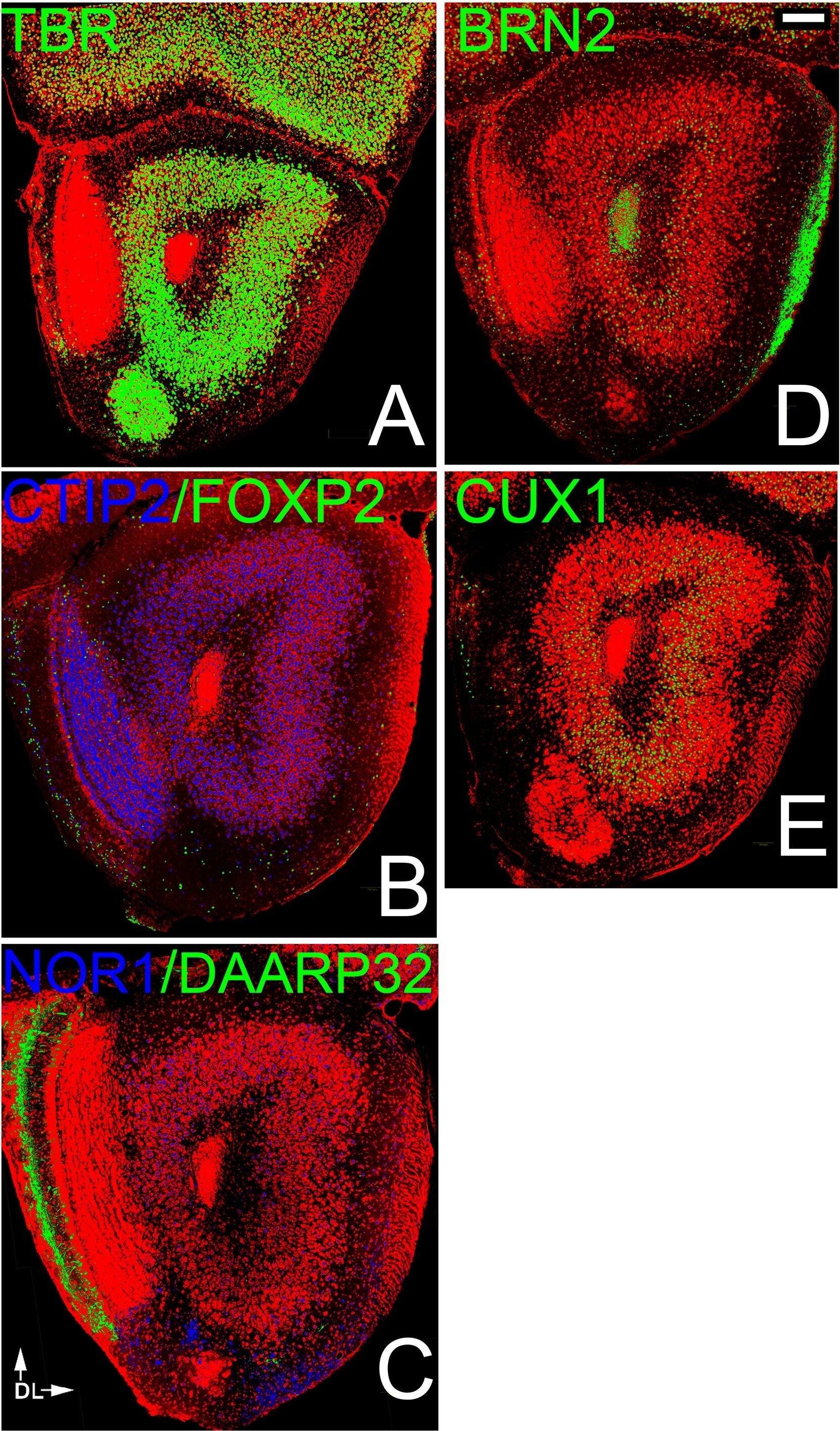 FoxP2 Antibody