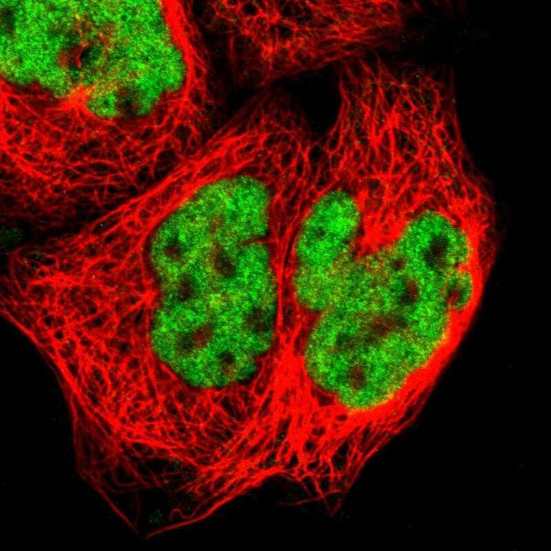 ZNF384 Antibody - BSA Free Immunocytochemistry/ Immunofluorescence: ZNF384 Antibody [NBP1-86675]