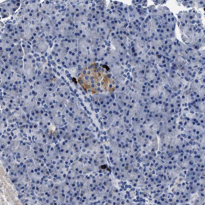 Cav1.3 Antibody - BSA Free Immunohistochemistry-Paraffin: Cav1.3 Antibody - BSA Free [NBP1-86684]