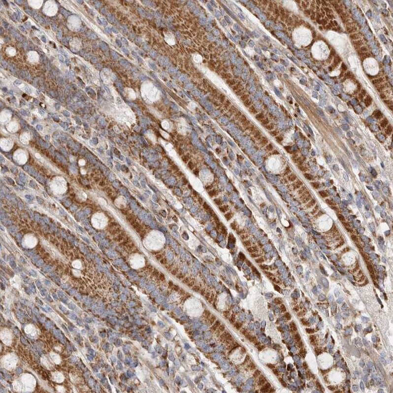 SLC25A20 Antibody - BSA Free Immunohistochemistry-Paraffin: SLC25A20 Antibody - BSA Free [NBP1-86689]