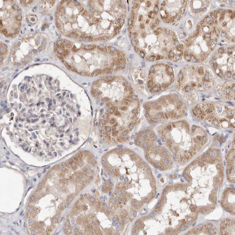 SLC25A20 Antibody - BSA Free Immunohistochemistry-Paraffin: SLC25A20 Antibody - BSA Free [NBP1-86689]