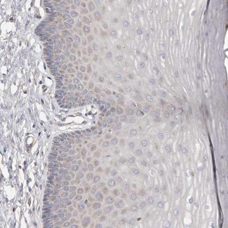 SLC25A20 Antibody - BSA Free Immunohistochemistry-Paraffin: SLC25A20 Antibody - BSA Free [NBP1-86689]