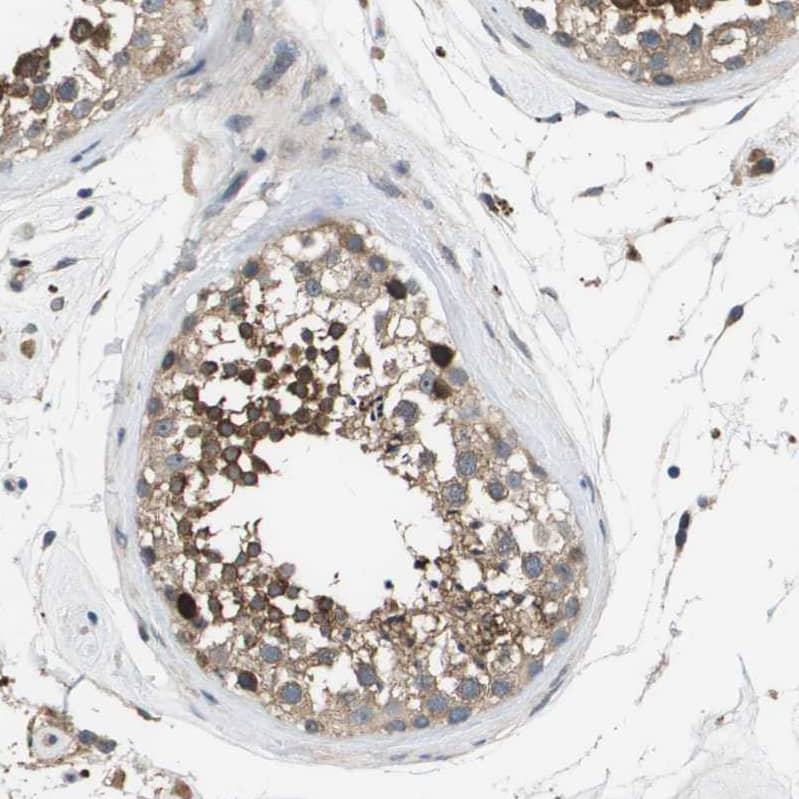 SLC25A20 Antibody - BSA Free Immunohistochemistry-Paraffin: SLC25A20 Antibody [NBP1-86690]