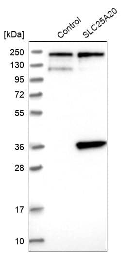 SLC25A20 Antibody - BSA Free Western Blot: SLC25A20 Antibody - BSA Free [NBP1-86690]