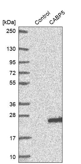 CABP5 Antibody - BSA Free Western Blot: CABP5 Antibody - BSA Free [NBP1-86691]