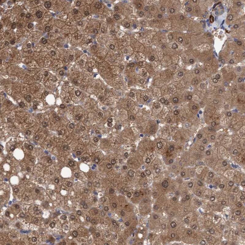 TSTD2 Antibody - BSA Free Immunohistochemistry-Paraffin: TSTD2 Antibody - BSA Free [NBP1-86696]
