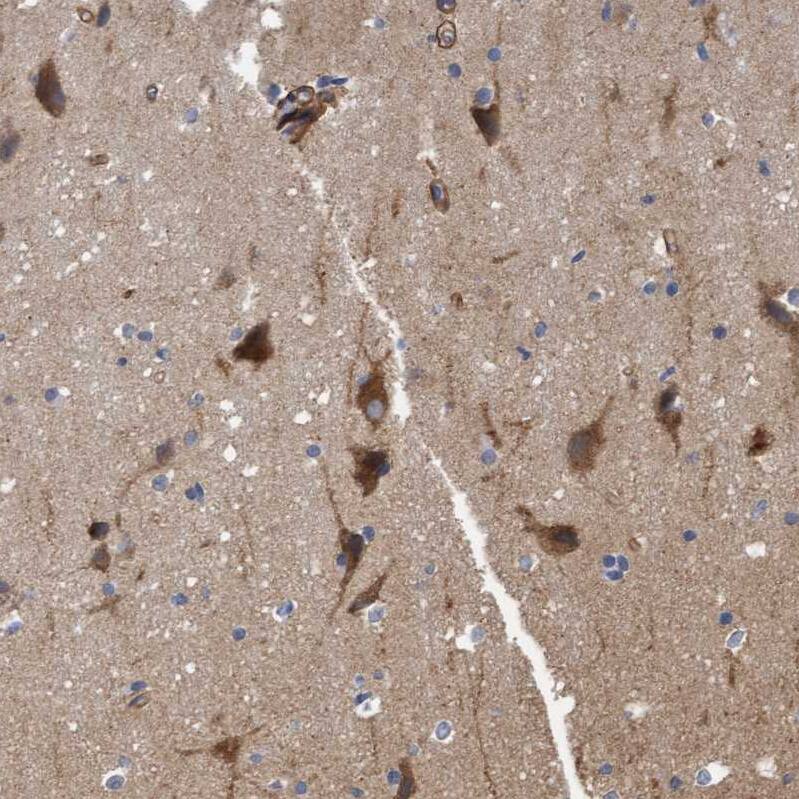 TSTD2 Antibody - BSA Free Immunohistochemistry-Paraffin: TSTD2 Antibody - BSA Free [NBP1-86696]