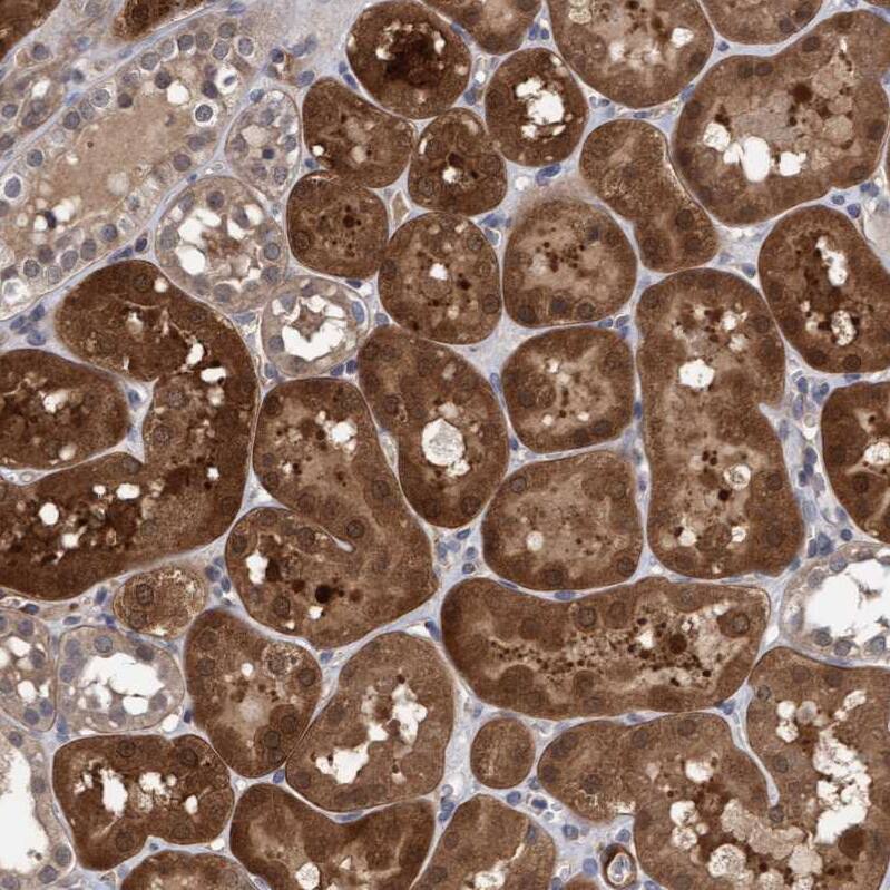 TSTD2 Antibody - BSA Free Immunohistochemistry-Paraffin: TSTD2 Antibody - BSA Free [NBP1-86696]