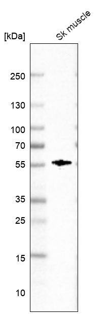FAM189A2 Antibody - BSA Free Western Blot: FAM189A2 Antibody - BSA Free [NBP1-86698]