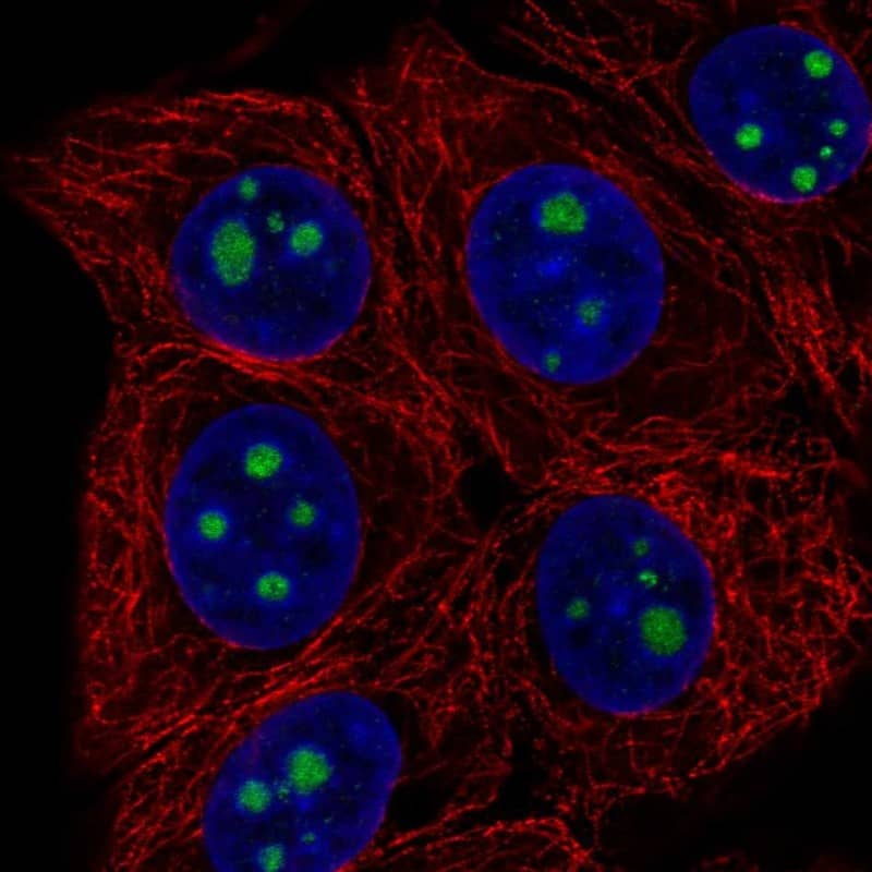 HDHD3 Antibody - BSA Free Immunohistochemistry-Paraffin: HDHD3 Antibody - BSA Free [NBP1-86706]