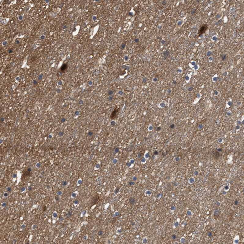SCAI Antibody - BSA Free Immunohistochemistry-Paraffin: SCAI Antibody - BSA Free [NBP1-86711]