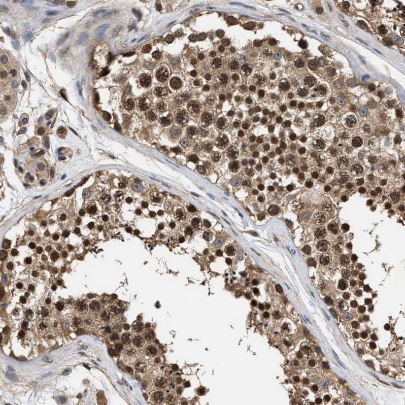 SCAI Antibody - BSA Free Immunohistochemistry-Paraffin: SCAI Antibody - BSA Free [NBP1-86711]