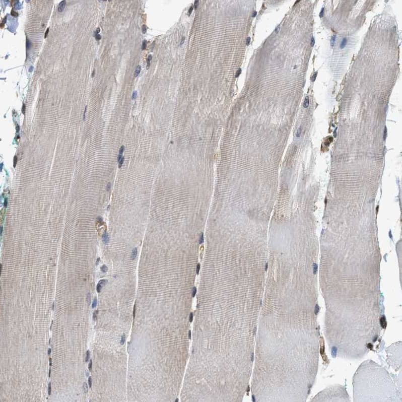 SCAI Antibody - BSA Free Immunohistochemistry-Paraffin: SCAI Antibody - BSA Free [NBP1-86711]