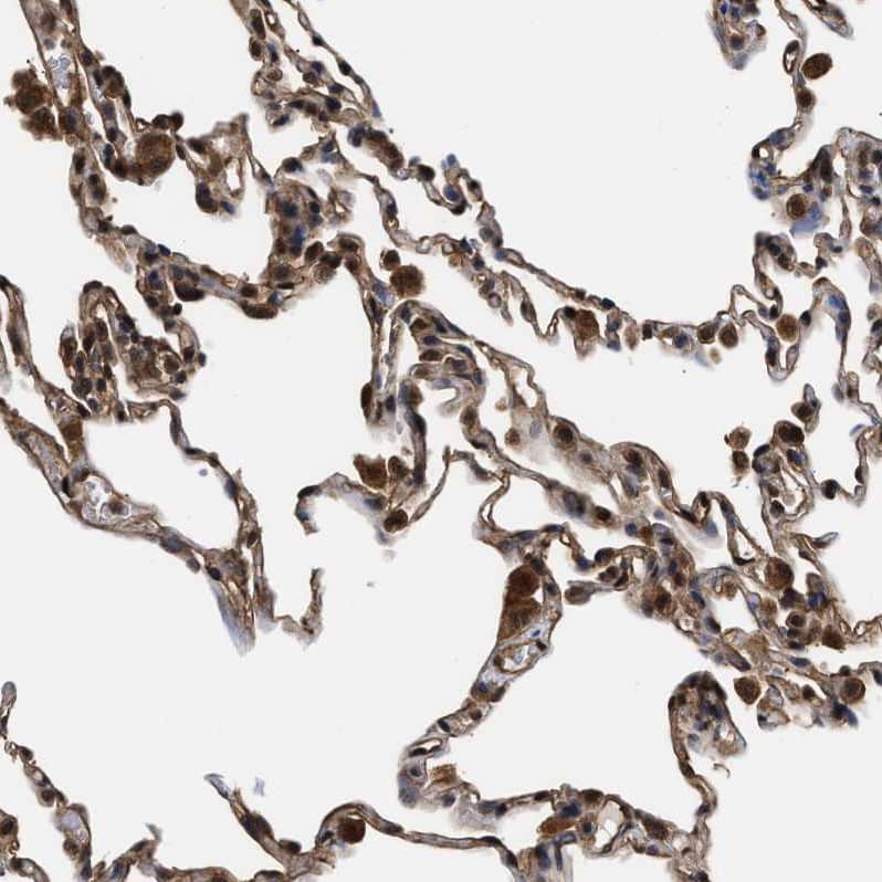 SCAI Antibody - BSA Free Immunohistochemistry-Paraffin: SCAI Antibody - BSA Free [NBP1-86711]