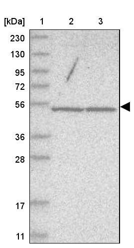 WDR85 Antibody - BSA Free Western Blot: WDR85 Antibody - BSA Free [NBP1-86714]