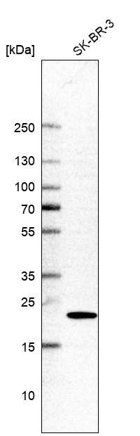 gamma-Glutamylcyclotransferase/CRF21/GGCT Antibody - BSA Free Western Blot: gamma-Glutamylcyclotransferase/CRF21/GGCT Antibody - BSA Free [NBP1-86727]
