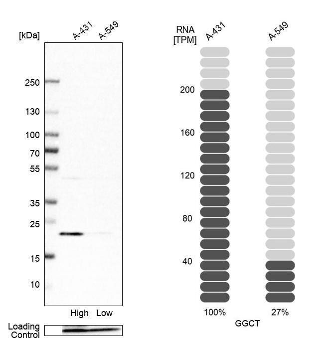 gamma-Glutamylcyclotransferase/CRF21/GGCT Antibody - BSA Free Western Blot: gamma-Glutamylcyclotransferase/CRF21/GGCT Antibody - BSA Free [NBP1-86728]