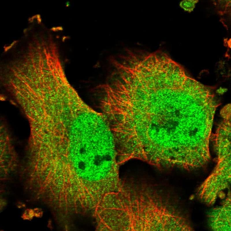TMUB1 Antibody - BSA Free Immunocytochemistry/ Immunofluorescence: TMUB1 Antibody [NBP1-86731]