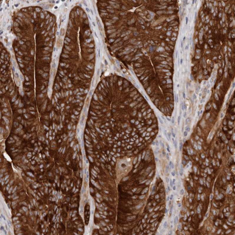 LTV1 Antibody - BSA Free Immunohistochemistry-Paraffin: LTV1 Antibody - BSA Free [NBP1-86734]