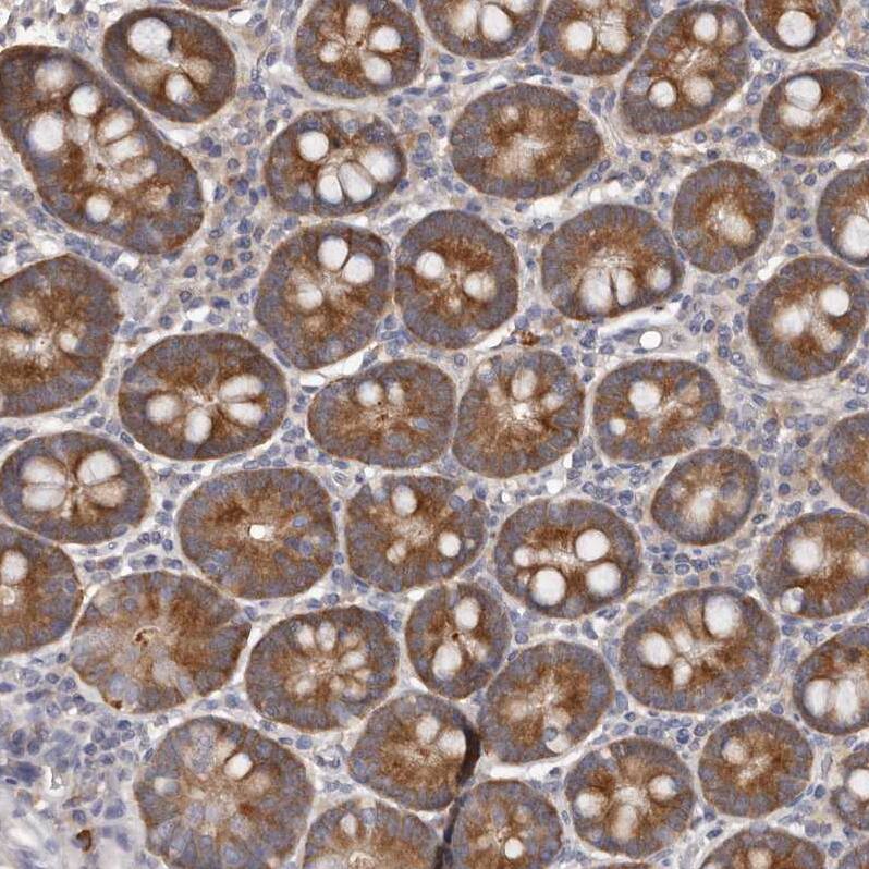 LTV1 Antibody - BSA Free Immunohistochemistry-Paraffin: LTV1 Antibody - BSA Free [NBP1-86734]