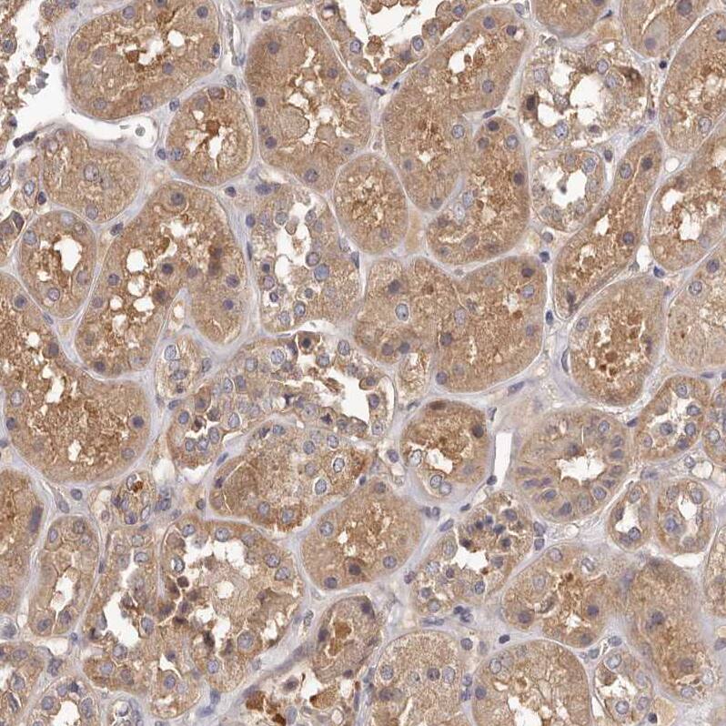 LTV1 Antibody - BSA Free Immunohistochemistry-Paraffin: LTV1 Antibody - BSA Free [NBP1-86734]