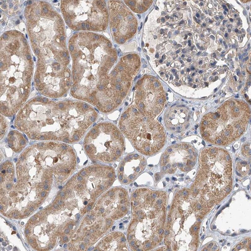 LTV1 Antibody - BSA Free Immunohistochemistry-Paraffin: LTV1 Antibody - BSA Free [NBP1-86735]
