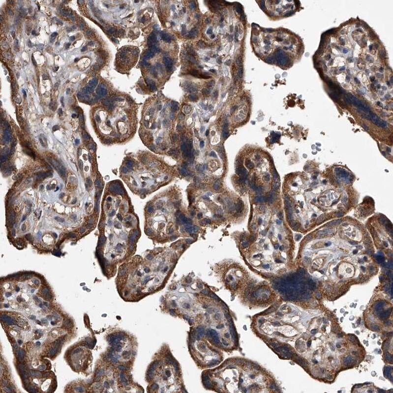 LTV1 Antibody - BSA Free Immunohistochemistry-Paraffin: LTV1 Antibody - BSA Free [NBP1-86735]