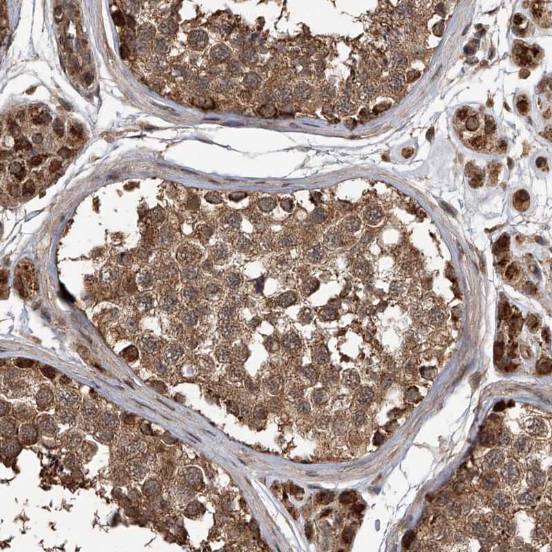 LTV1 Antibody - BSA Free Immunohistochemistry-Paraffin: LTV1 Antibody - BSA Free [NBP1-86735]