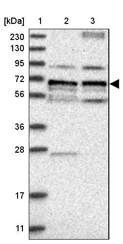 LTV1 Antibody - BSA Free Western Blot: LTV1 Antibody - BSA Free [NBP1-86735]