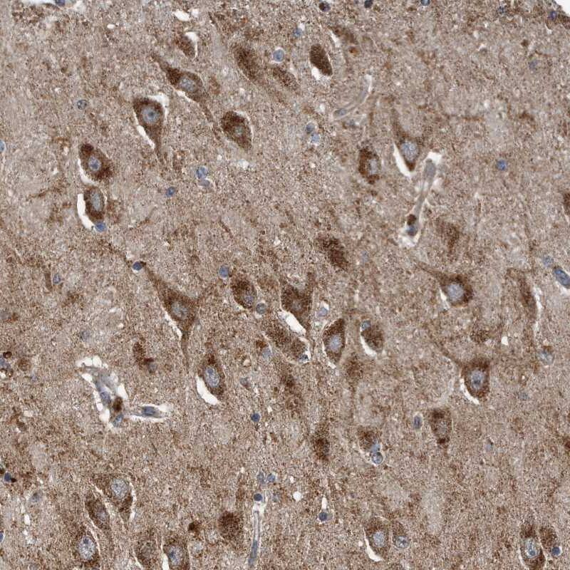 LYRM4 Antibody - BSA Free Immunohistochemistry-Paraffin: LYRM4 Antibody [NBP1-86762]