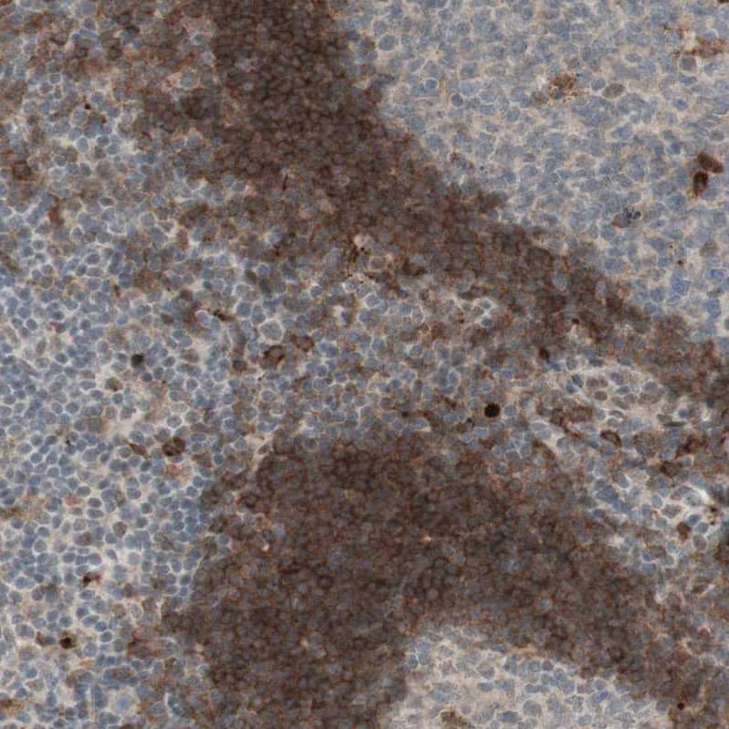 GAPT Antibody - BSA Free Immunohistochemistry-Paraffin: GAPT Antibody - BSA Free [NBP1-86773]
