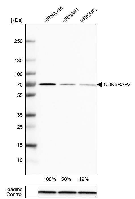 CDK5RAP3 Antibody - BSA Free Western Blot: CDK5RAP3 Antibody - BSA Free [NBP1-86780]