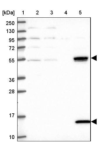 UFSP2 Antibody - BSA Free Western Blot: UFSP2 Antibody - BSA Free [NBP1-86781]