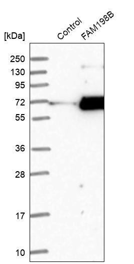 FAM198B Antibody - BSA Free Western Blot: FAM198B Antibody - BSA Free [NBP1-86783]