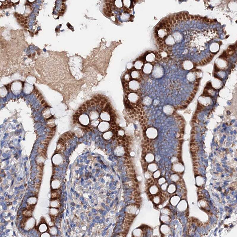 SLC10A7 Antibody - BSA Free Immunohistochemistry-Paraffin: SLC10A7 Antibody - BSA Free [NBP1-86784]