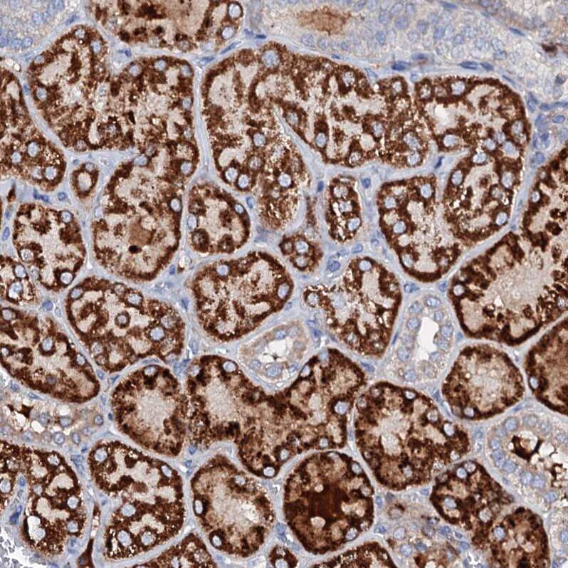 SLC10A7 Antibody - BSA Free Immunohistochemistry-Paraffin: SLC10A7 Antibody - BSA Free [NBP1-86784]