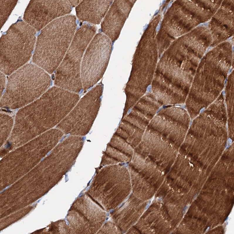SLC10A7 Antibody - BSA Free Immunohistochemistry-Paraffin: SLC10A7 Antibody - BSA Free [NBP1-86784]