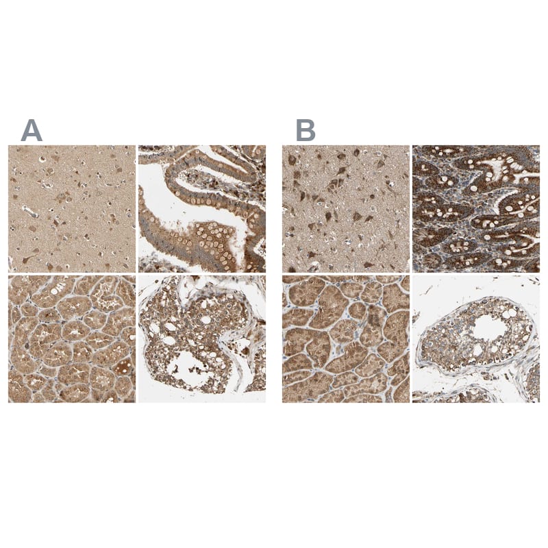 MRPS22 Antibody - BSA Free Immunohistochemistry-Paraffin: MRPS22 Antibody - BSA Free [NBP1-86788]