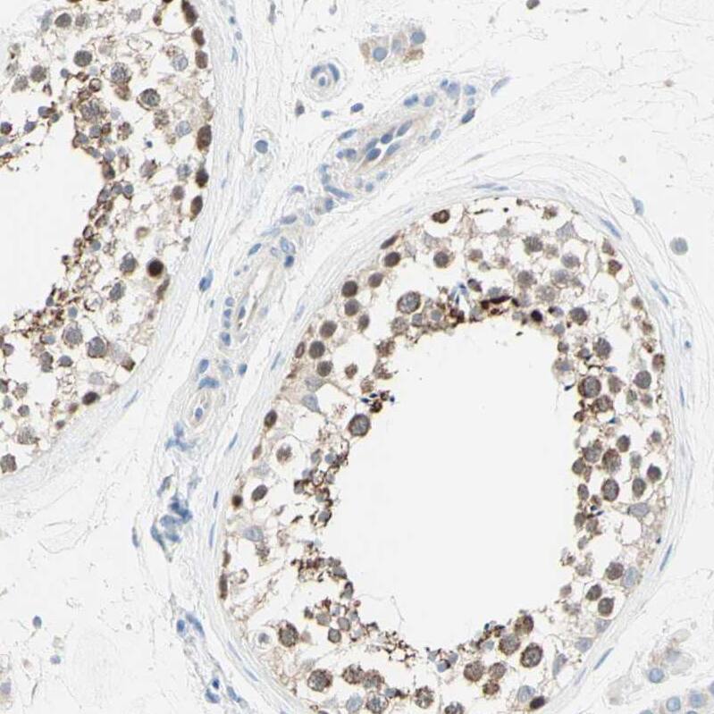 MFF Antibody - BSA Free Immunohistochemistry-Paraffin: MFF Antibody - BSA Free [NBP1-86799]