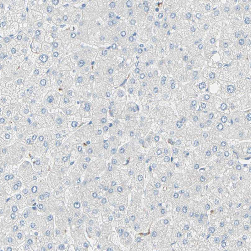 MFF Antibody - BSA Free Immunohistochemistry-Paraffin: MFF Antibody - BSA Free [NBP1-86799]