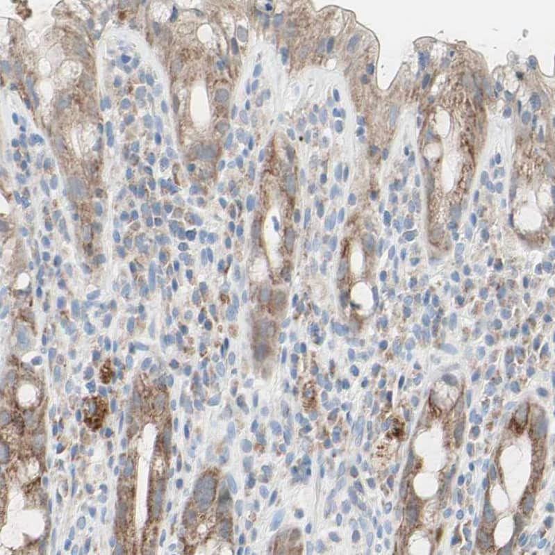 MFF Antibody - BSA Free Immunohistochemistry-Paraffin: MFF Antibody - BSA Free [NBP1-86799]