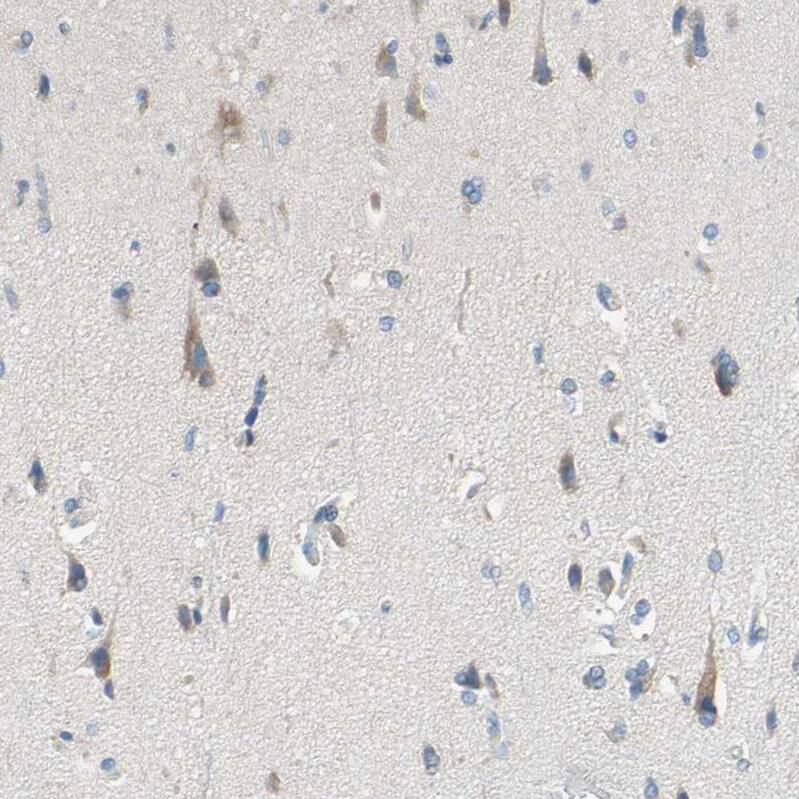 MFF Antibody - BSA Free Immunohistochemistry-Paraffin: MFF Antibody - BSA Free [NBP1-86799]