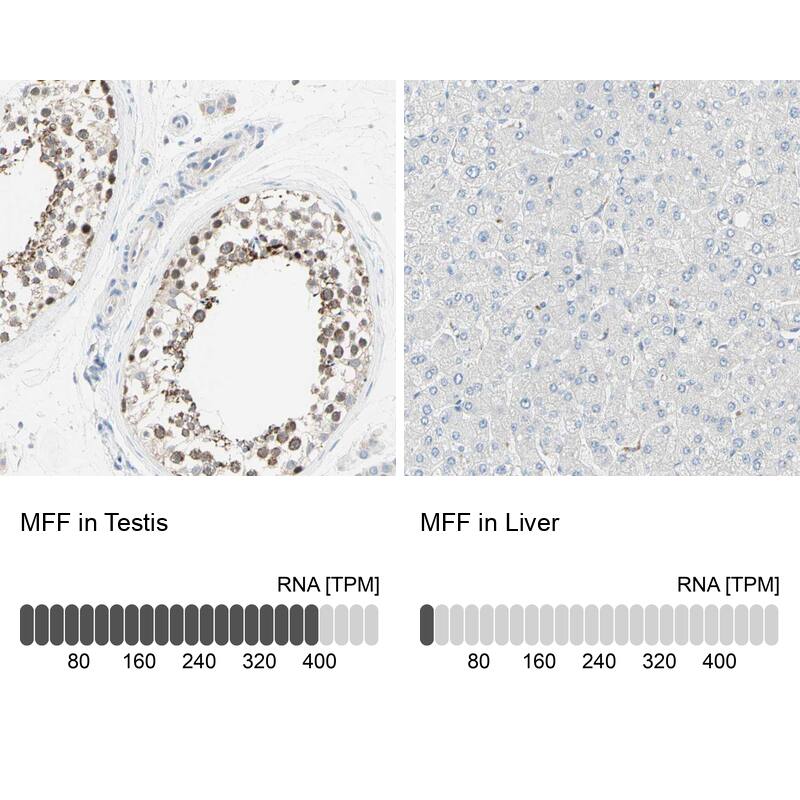 MFF Antibody - BSA Free Immunohistochemistry-Paraffin: MFF Antibody - BSA Free [NBP1-86799]