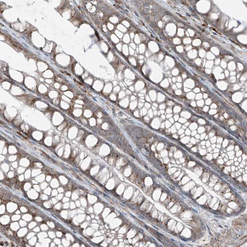 ERLEC1 Antibody - BSA Free Immunohistochemistry-Paraffin: ERLEC1 Antibody - BSA Free [NBP1-86801]
