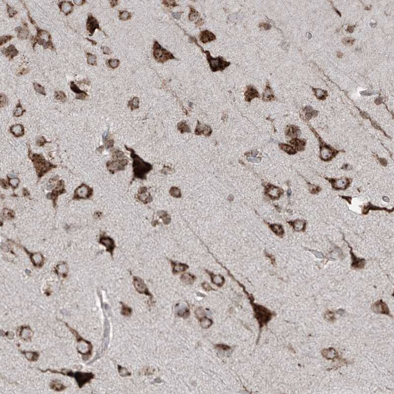ERLEC1 Antibody - BSA Free Immunohistochemistry-Paraffin: ERLEC1 Antibody - BSA Free [NBP1-86801]